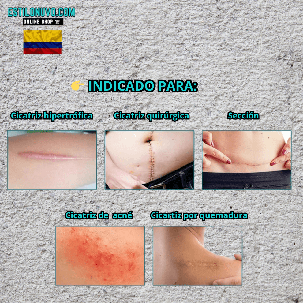 ScarFade™ Reduce cicatrices y marcas visibles.