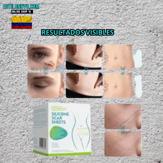 ScarFade™ Reduce cicatrices y marcas visibles.